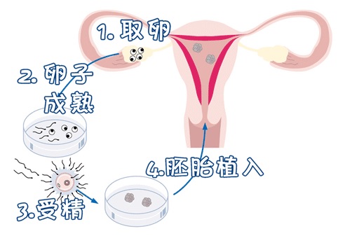 试管捐卵机构